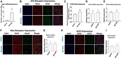 Suppression of Inflammatory Cardiac Cytokine Network in Rats with Untreated Obesity and Pre-Diabetes by AT2 Receptor Agonist NP-6A4